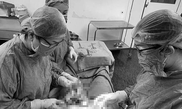 Hiếm gặp: Sản phụ mang thai đôi ở hai tử cung khác nhau