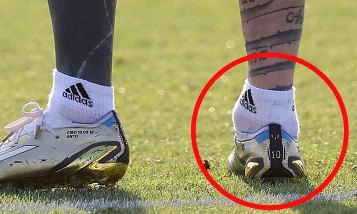 Mắt cá chân bất thường của Messi