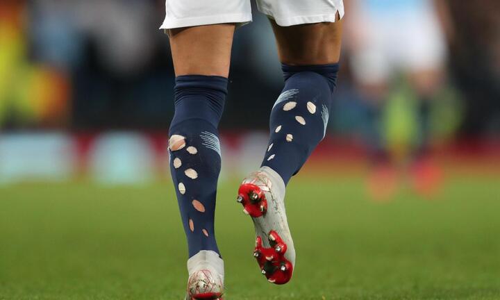 Vì sao các cầu thủ Anh mang tất thủng lỗ chỗ tại World Cup 2022?