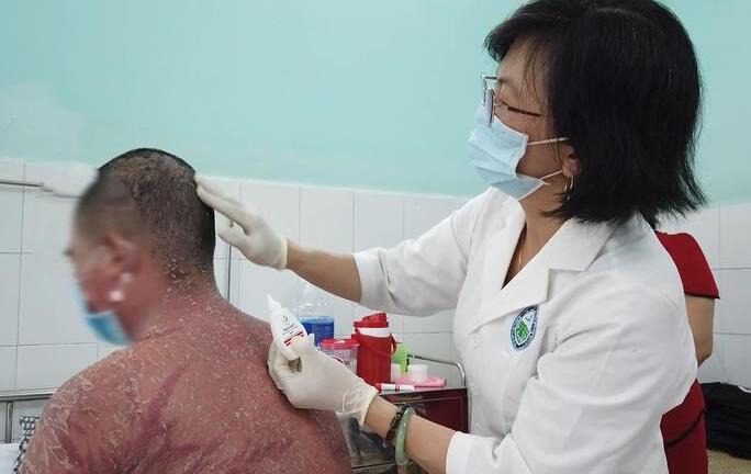 Nhập viện vì dùng thuốc chữa vảy nến trên mạng