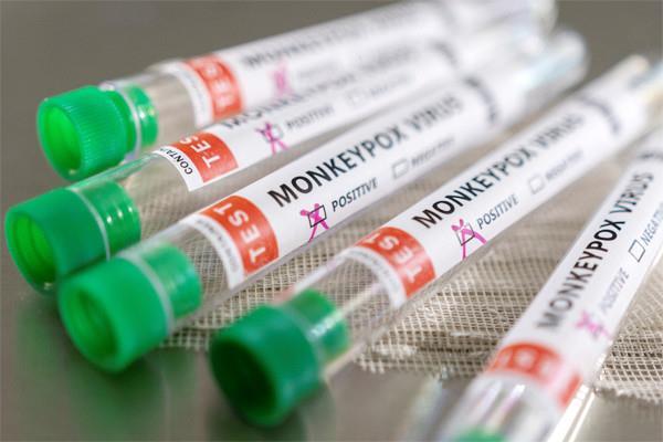 Việt Nam ghi nhận 6 ca tử vong liên quan đậu mùa khỉ 
