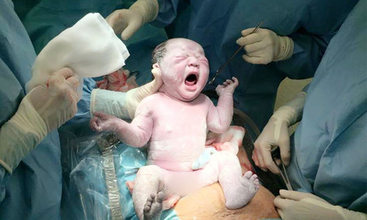 Không cho bác sĩ nam đỡ đẻ, mẹ chồng suýt hại cả con dâu và cháu