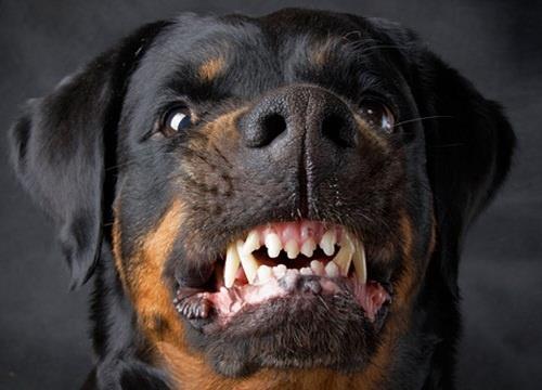 Bé 2 tuổi bị chó cắn trọng thương vùng đầu, mặt