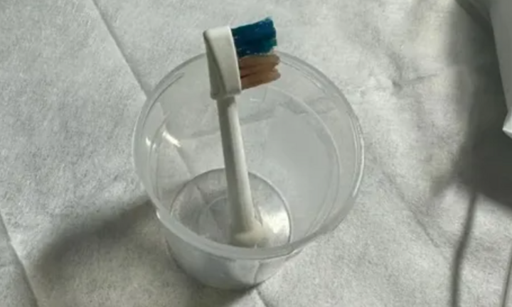 Bác sĩ sửng sốt phát hiện đầu bàn chải điện bên trong bụng cậu bé 9 tuổi