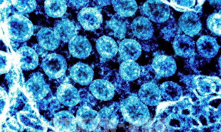 Xuất hiện biến thể phụ XBB của Omicron ở TP.HCM