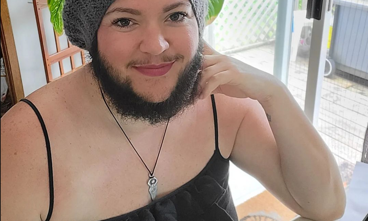 Người mẹ sở hữu bộ râu rậm rạp quyết định ngừng che giấu vẻ ngoài vì con trai