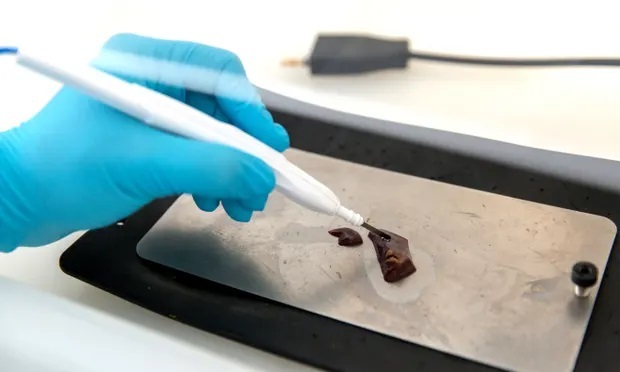 Thiết bị giúp phát hiện ung thư thường gặp ở phụ nữ chỉ trong vài giây