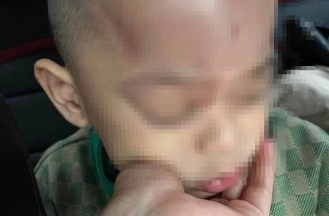 Xác minh thông tin trẻ bị bạo hành ở trường mầm non tại Đà Nẵng