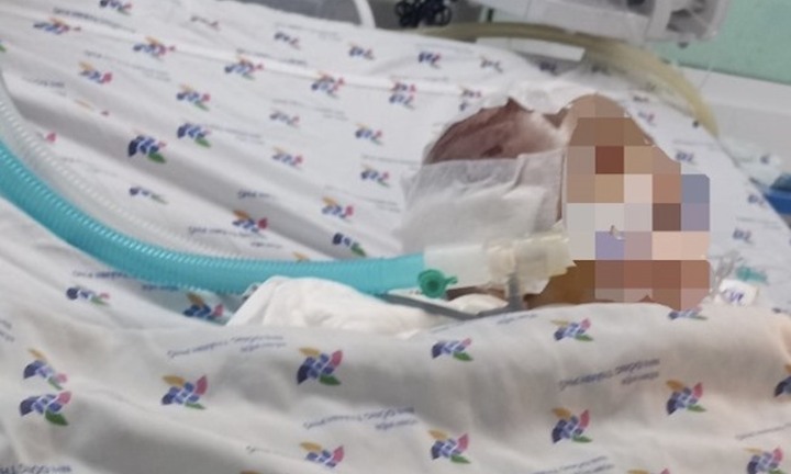 TP.HCM: Bé 6 tháng tuổi xuất huyết não nghi bị bạo hành