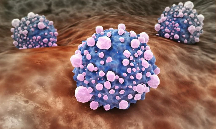 Những người dễ mắc nhiều loại ung thư cùng một lúc