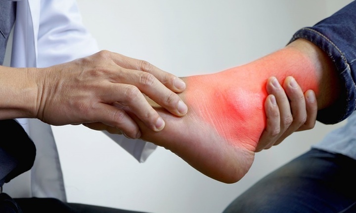 Người bị bệnh gút kiêng ăn gì? 