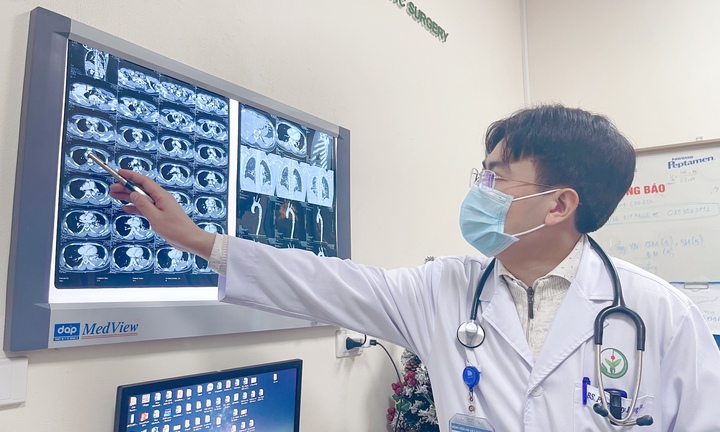 Lóc động mạch chủ - bệnh lý có thể gây đột tử ở người khỏe mạnh