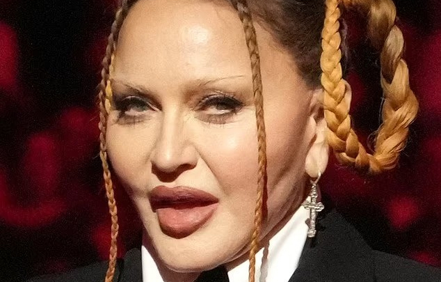 Nhan sắc nữ hoàng nhạc pop Madonna gây sốc, fan kêu gọi ngừng phẫu thuật thẩm mỹ