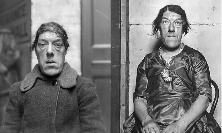 Ảnh hiếm và bi kịch của người phụ nữ xấu xí nhất thế giới