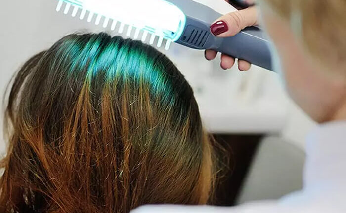 Cấy tóc, mọc tóc, giảm mỡ bụng - máy lazer làm được hết: Chuyên gia nói gì?