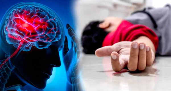 Đột quỵ sau cú ngã từ trên giường: Dấu hiệu cảnh báo nên biết