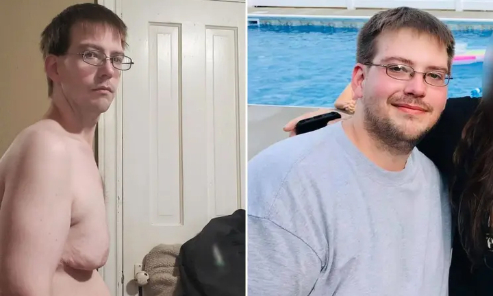 Nỗi khổ cô đơn của người đàn ông có vòng 1 lớn bất thường 