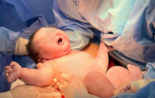 Bé sơ sinh nặng gần 6kg