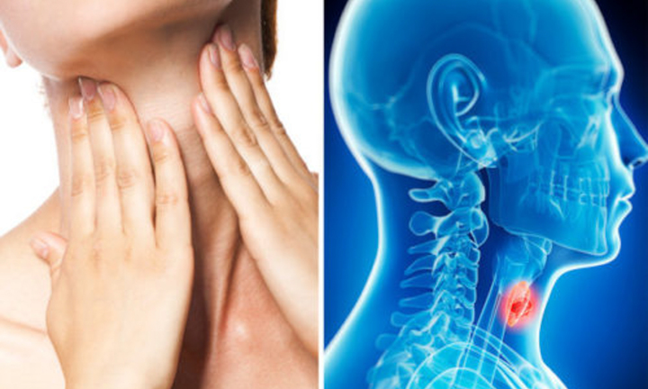 Dấu hiệu ung thư vòm họng sớm 