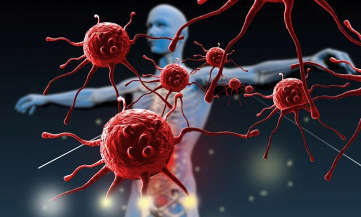 6 loại ung thư nguy hiểm nhất