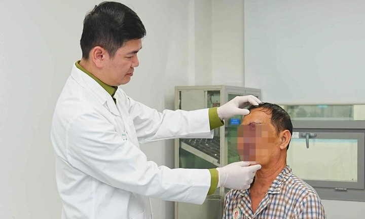 Bóc tách khối u như chùm nho trên mặt người đàn ông suốt 20 năm 