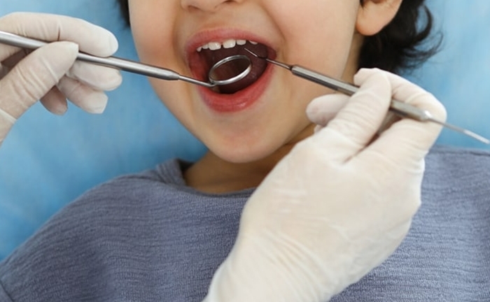 Bé trai 9 tuổi đau răng phát khóc, nào ngờ bố làm điều ai cũng sợ 