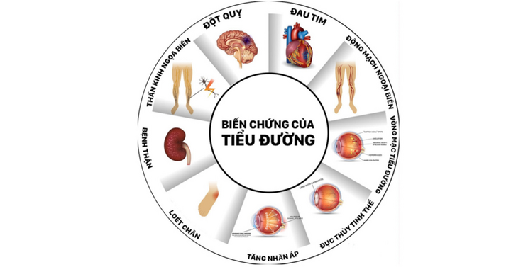 Diabetna giữ vững vị thế tiên phong hỗ trợ người tiểu đường
