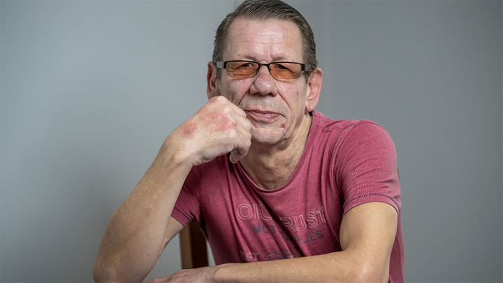 Bay từ Anh sang Ukraina chữa răng vì lý do này