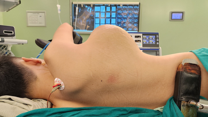 Phẫu thuật thành công bệnh nhân có khối u nặng 3kg bị nhiều bệnh viện từ chối