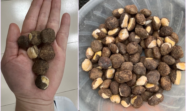 18 người ngộ độc do ăn phải loại hạt lạ chứa chất độc