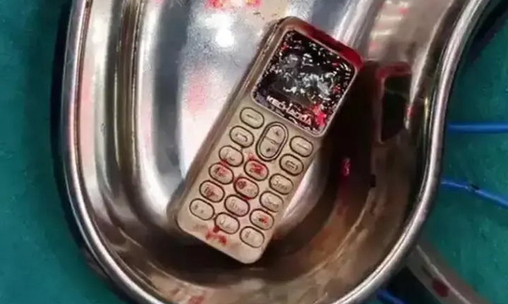 Cãi nhau với em trai, chị gái nuốt luôn điện thoại vào bụng