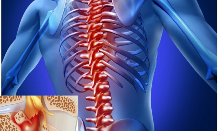 Nóng rát sau lưng là dấu hiệu của bệnh gì? 