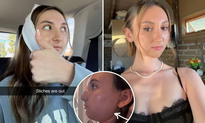 Chi hơn 4 tỷ phẫu thuật thẩm mỹ vì bị chê có khuôn mặt giống con sóc