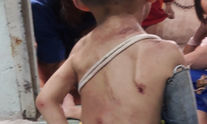 Bé trai 1 tuổi ở TP.HCM có dấu hiệu bị cha mẹ bạo hành 