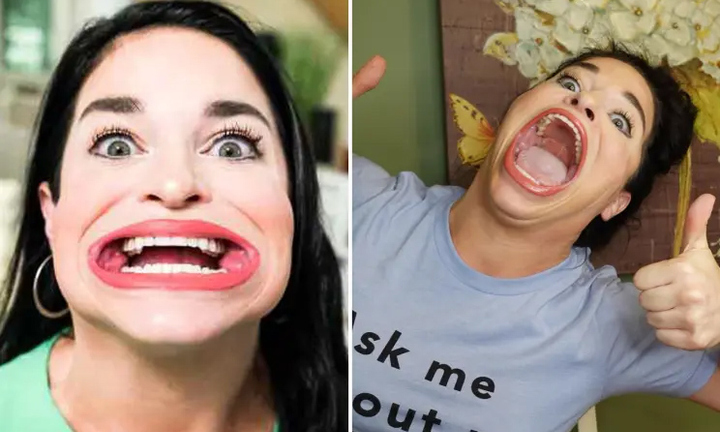 Người phụ nữ miệng rộng nhất thế giới kiếm được 300 triệu mỗi lần lên Tiktok