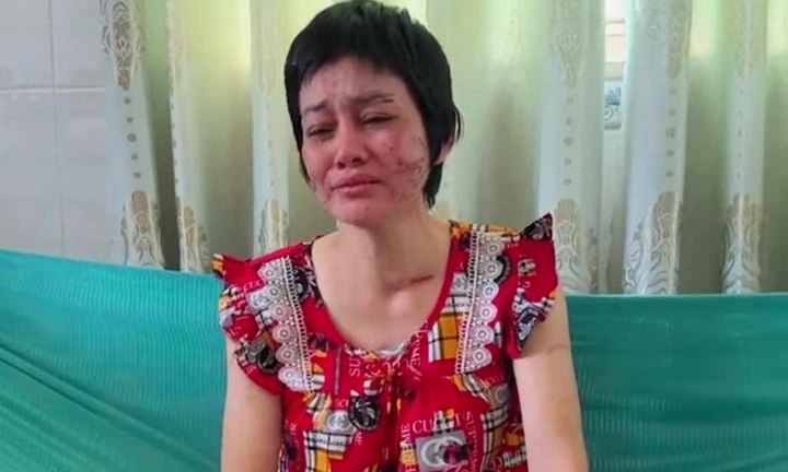 Người chồng thừa nhận dùng dây lưng đánh vợ mang bầu 7 tháng