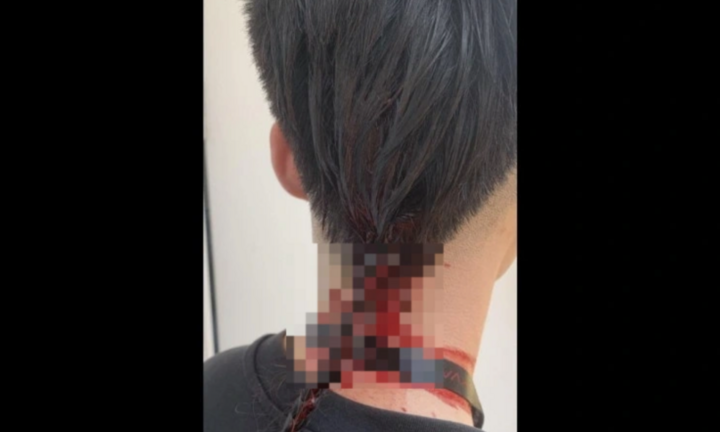 Mâu thuẫn cá nhân, sinh viên đại học ở Thủ đô đánh bạn chảy máu tại trường học