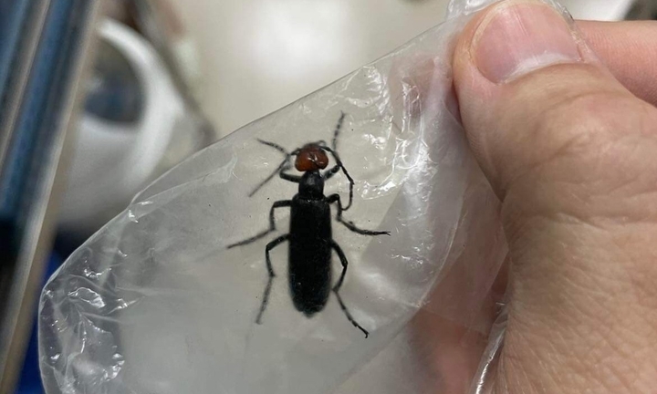 3 bệnh nhân nguy kịch sau khi ăn sâu ban miêu