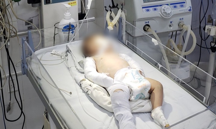 Sức khỏe bé gái 3 tháng tuổi ở Đà Lạt bị người tình của mẹ bạo hành giờ ra sao?