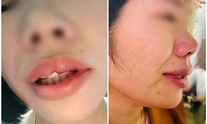 Xử phạt hành chính thầy giáo xông vào nhà hành hung nữ đồng nghiệp ở Đắk Nông