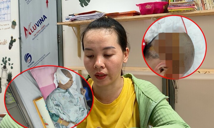 Bé gái 10 tuổi mổ não 4 lần, liệt nửa người vì ung thư