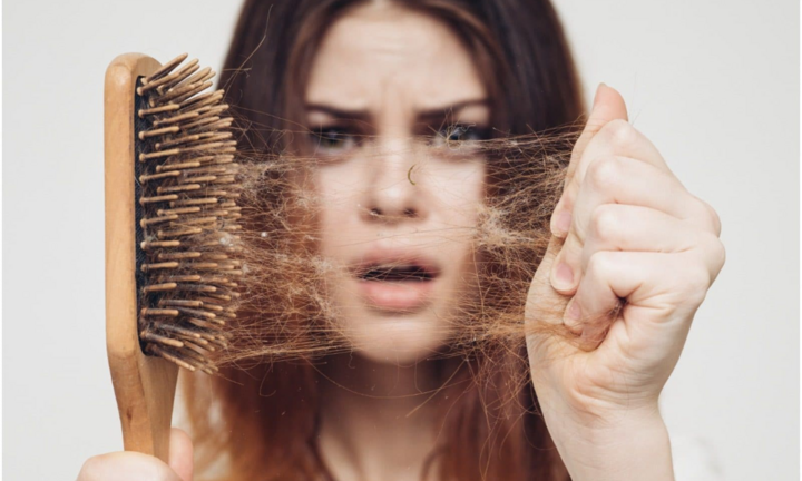 Vì sao nhiều người hói đầu dù tuổi còn rất trẻ?