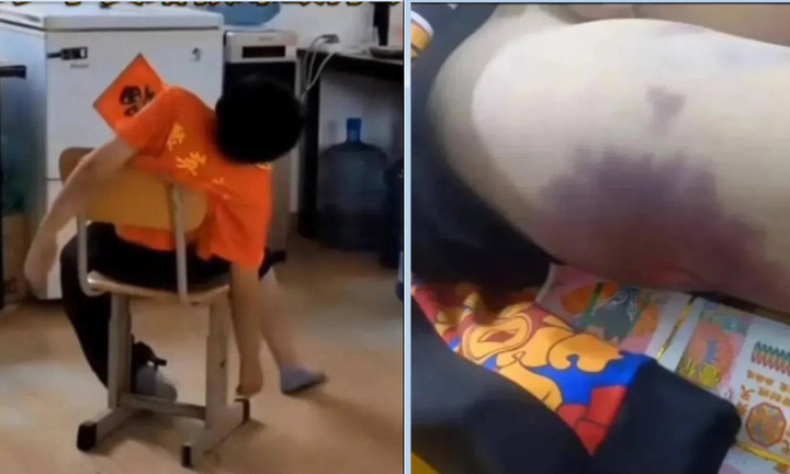 Cậu bé 8 tuổi đột tử sau một buổi học võ