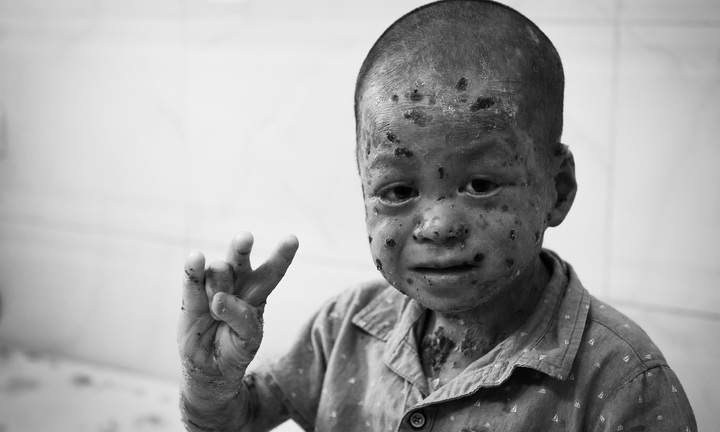 Cuộc gọi từ người lạ và hành trình 9 năm nhận nuôi em bé mắc bệnh hiếm