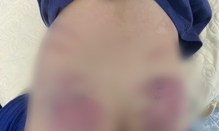 Công an Hà Nội xác minh nghi vấn cháu bé 9 tuổi bị cô giáo dạy can thiệp bạo hành