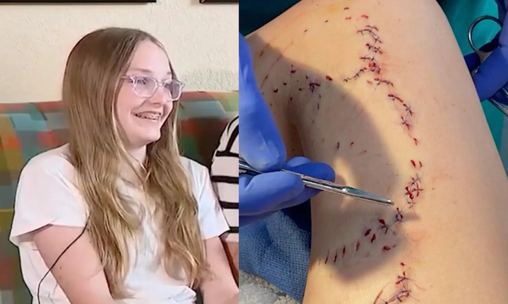 Bé gái thoát chết sau 2 lần bị cá mập tấn công với gần trăm vết cắn