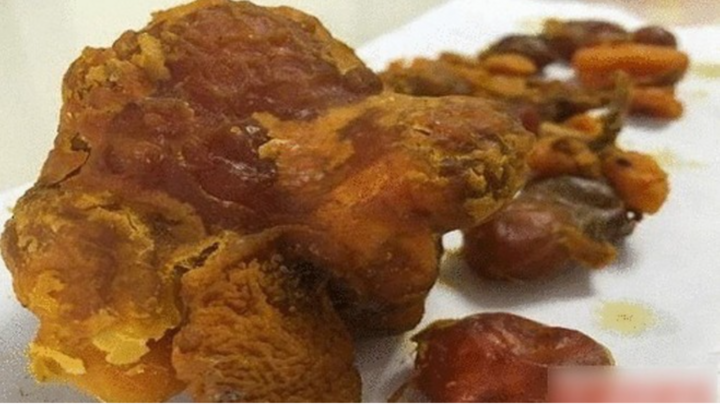 Phát hiện 'vật thể lạ' trong bụng con gà, nhiều người đề nghị mua lại giá tiền tỷ