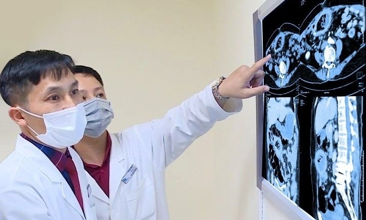 Phát hiện băng gạc bị bỏ quên 10 năm trong bụng bệnh nhân