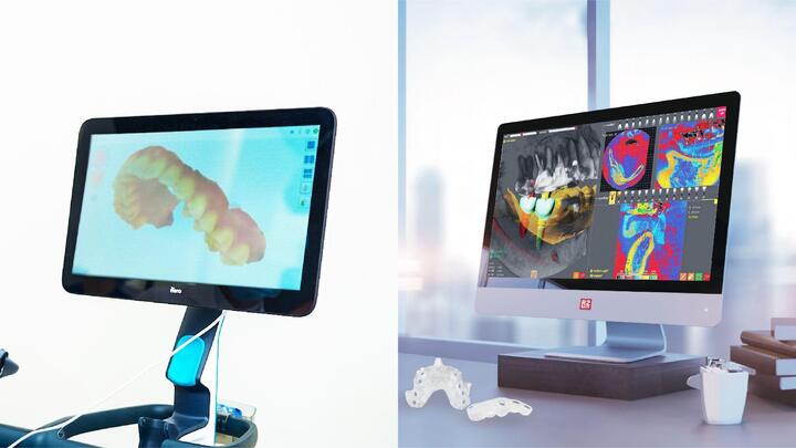 Nha Khoa Kim triển khai dịch vụ răng sứ, Implant nhanh chóng, an toàn