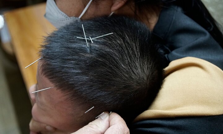 Vị đại tá 17 năm châm cứu điều trị cho trẻ bại não, tự kỷ